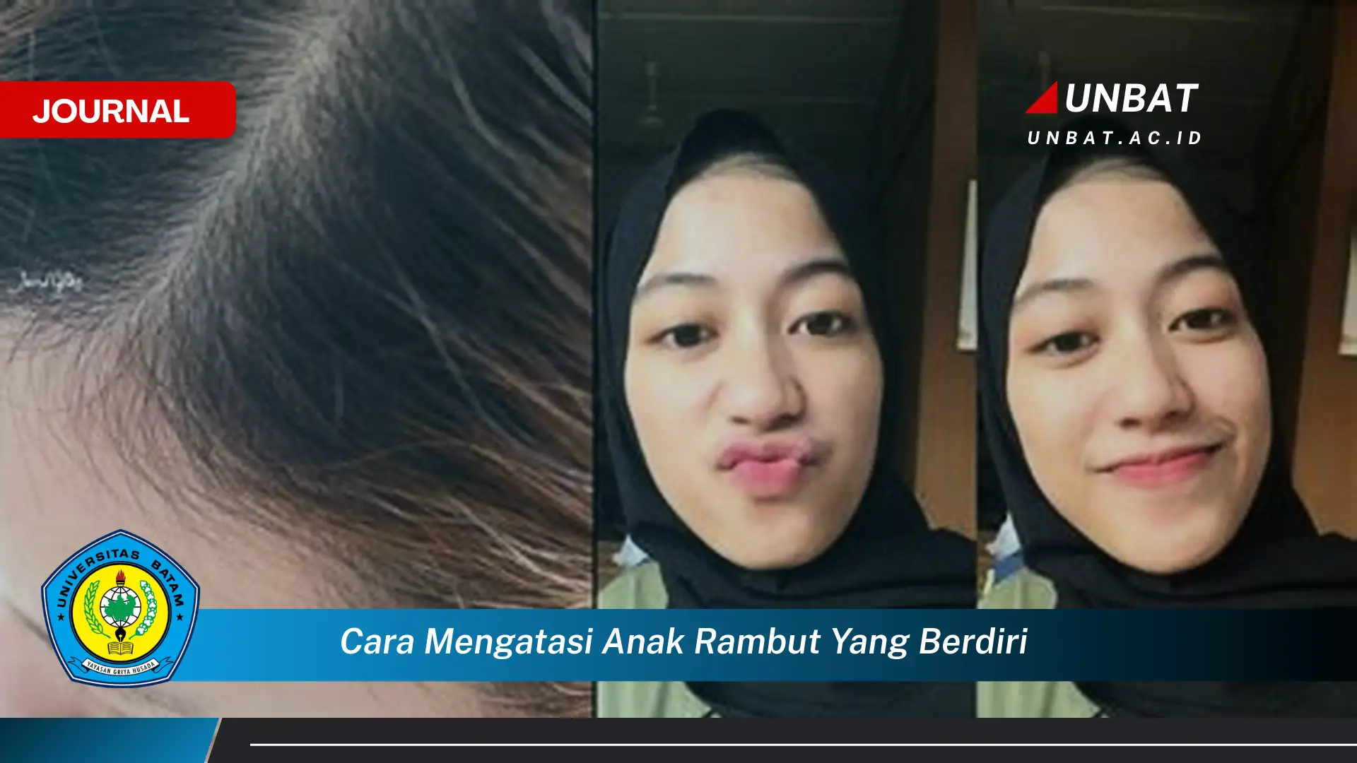 Ketahui Cara Mengatasi Anak Rambut yang Berdiri, Tips Mudah dan Efektif