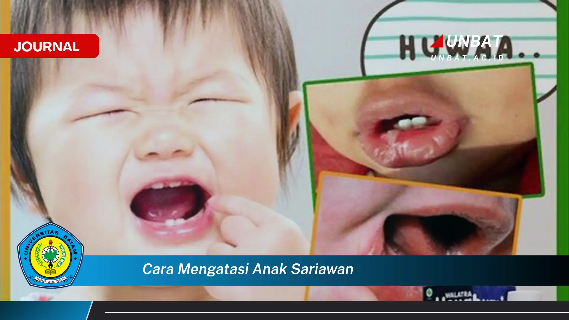 Ketahui Cara Mengatasi Sariawan pada Anak, Tips Ampuh dan Alami