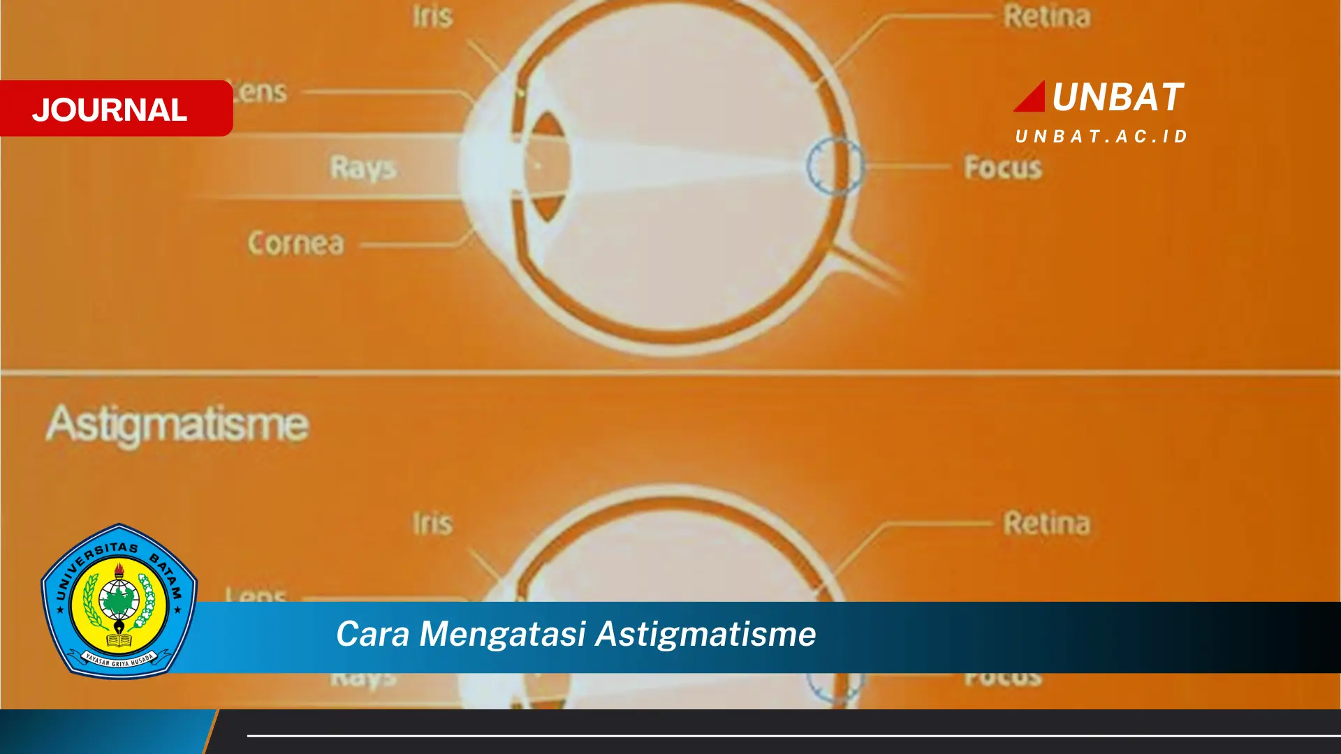 Ketahui Cara Mengatasi Astigmatisme Secara Efektif dan Alami