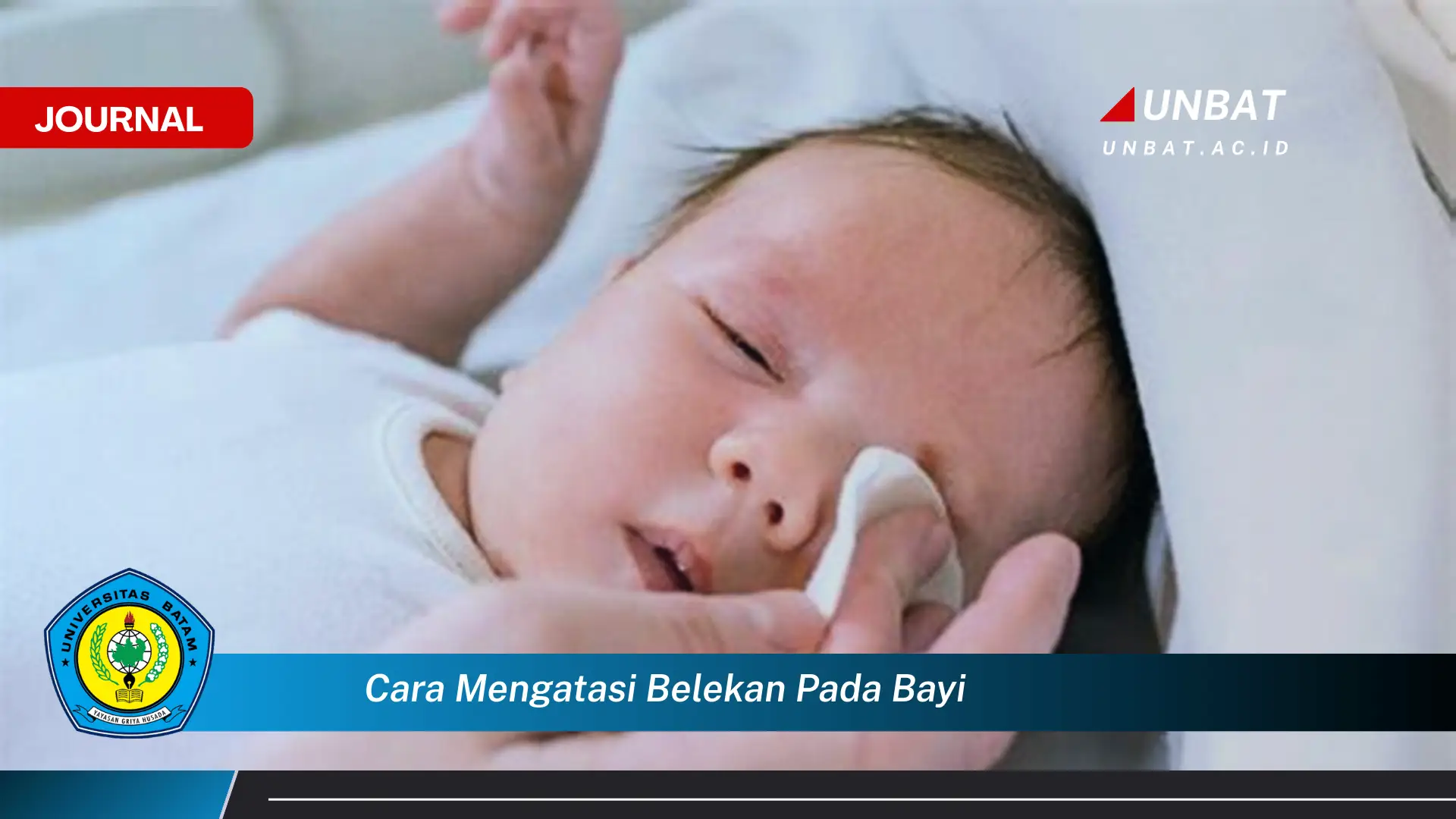 Ketahui Cara Mengatasi Belekan pada Bayi dengan Cepat dan Aman Ketahui Cara Mengatasi Belekan pada Bayi dengan Cepat dan Aman