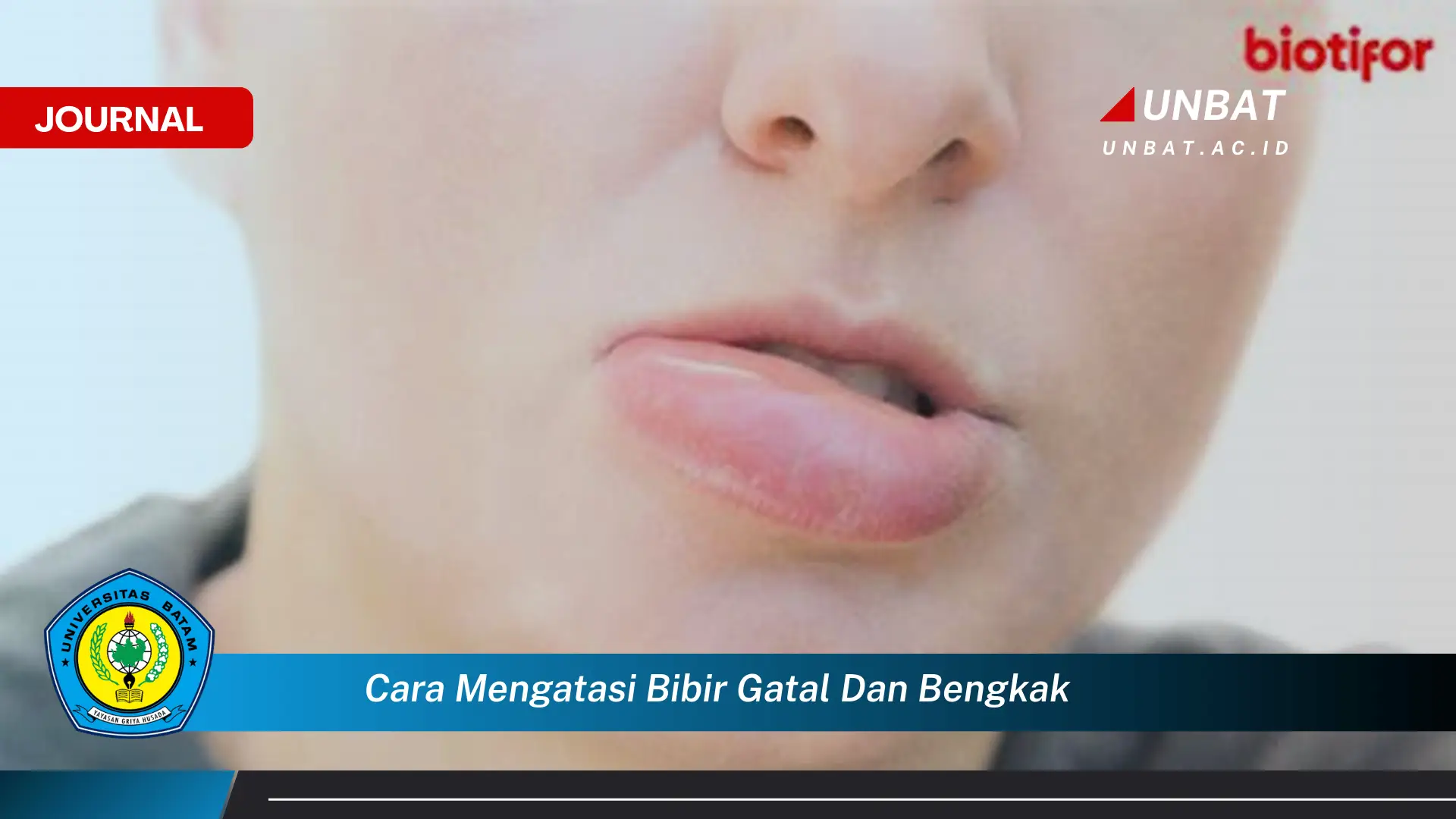 Ketahui Cara Mengatasi Bibir Gatal dan Bengkak Secara Efektif