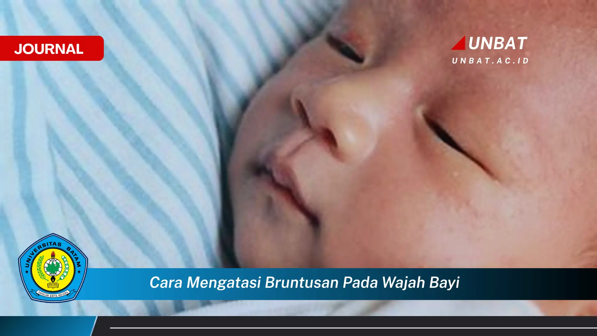 Inilah Cara Mengatasi Bruntusan pada Wajah Bayi, Panduan Lengkap untuk Kulit Sehat Si Kecil