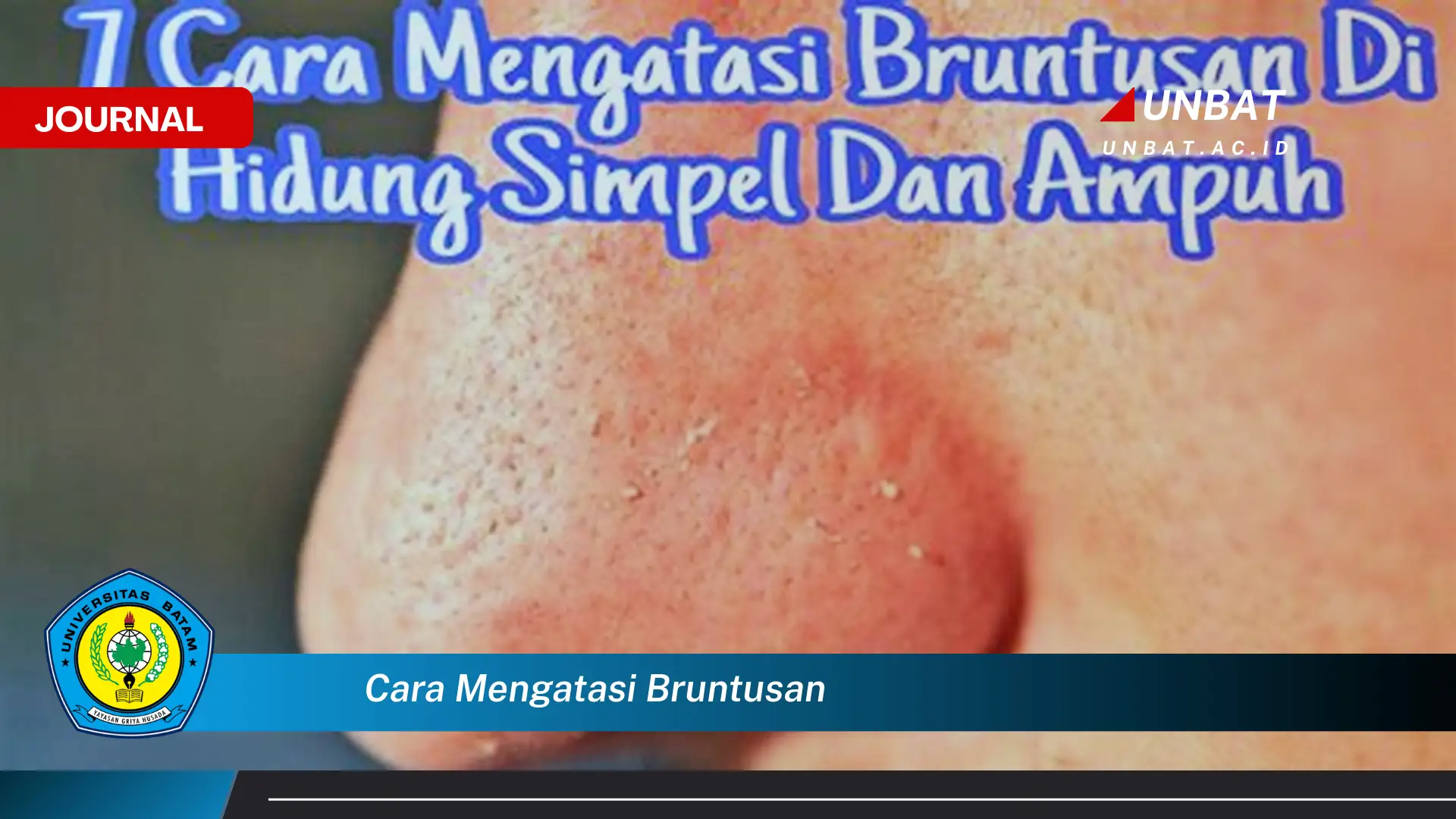 Inilah Cara Mengatasi Bruntusan, Panduan Lengkap untuk Kulit Mulus dan Sehat Alami