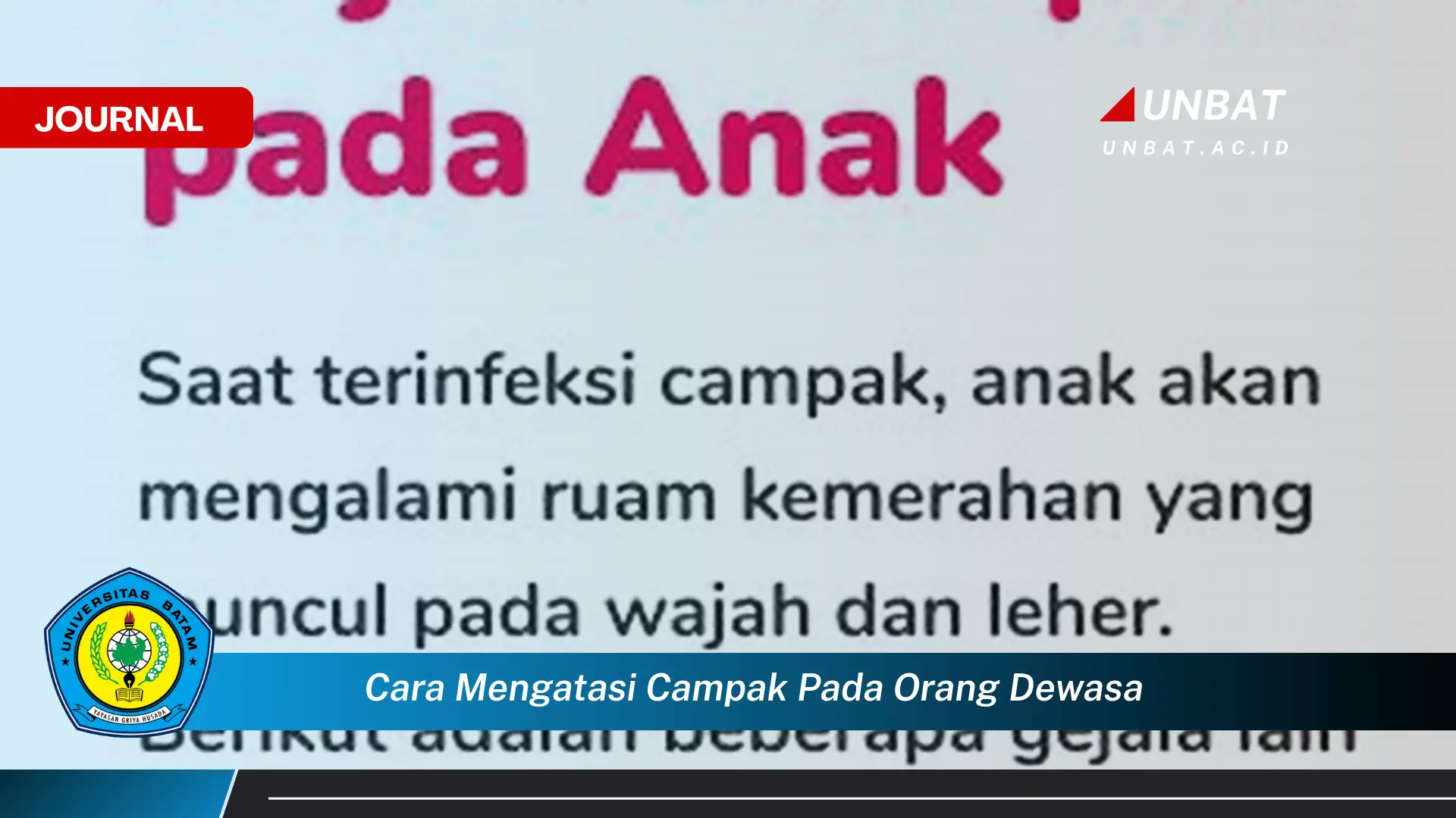 Ketahui Cara Mengatasi Campak pada Orang Dewasa Secara Efektif dan Cepat