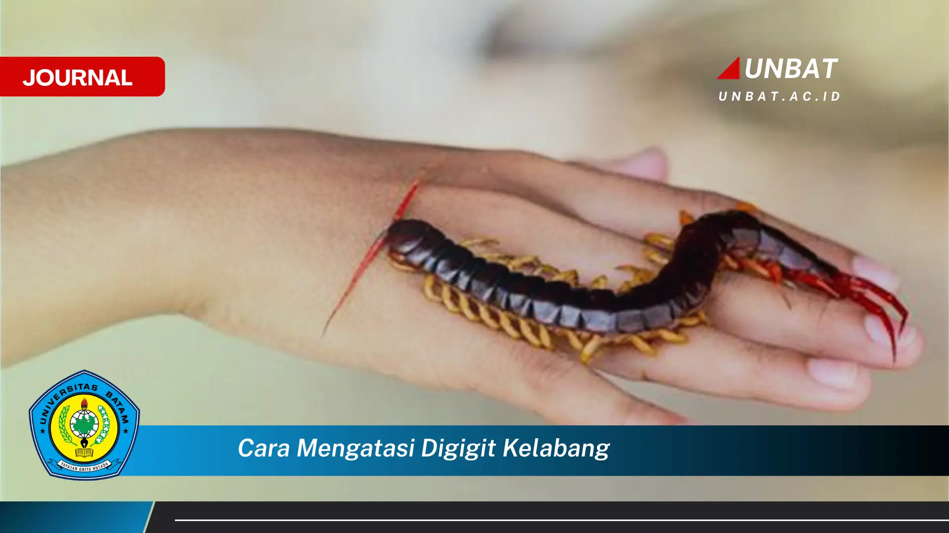 Ketahui Cara Mengatasi Digigit Kelabang, Pertolongan Pertama dan Tips Cepat Redakan Nyeri Ketahui Cara Mengatasi Digigit Kelabang, Pertolongan Pertama dan Tips Cepat Redakan Nyeri