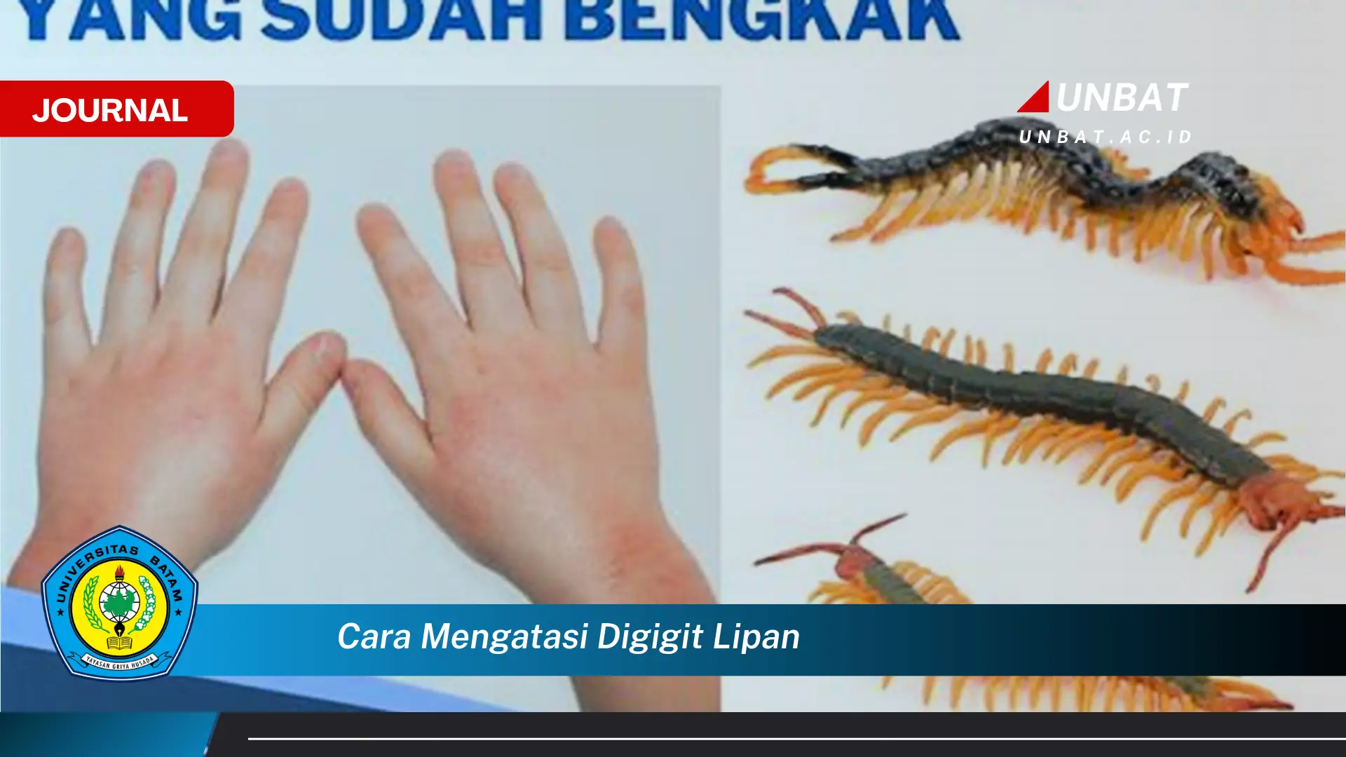 Ketahui Cara Mengatasi Gigitan Lipan, Pertolongan Pertama dan Tips Pencegahan Ketahui Cara Mengatasi Gigitan Lipan, Pertolongan Pertama dan Tips Pencegahan