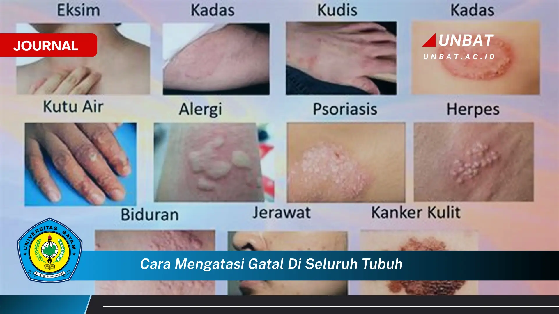 Ketahui Cara Mengatasi Gatal di Seluruh Tubuh Secara Efektif dan Alami