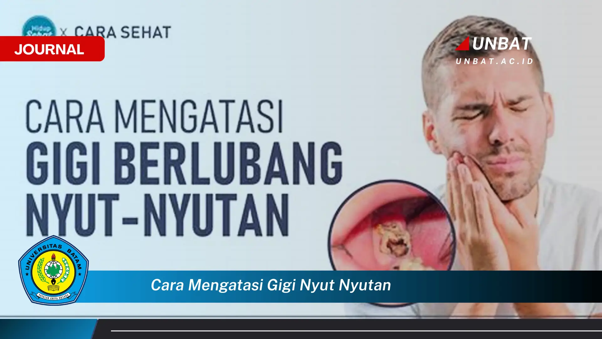 Ketahui Cara Mengatasi Gigi Nyut,nyutan dengan Cepat dan Alami