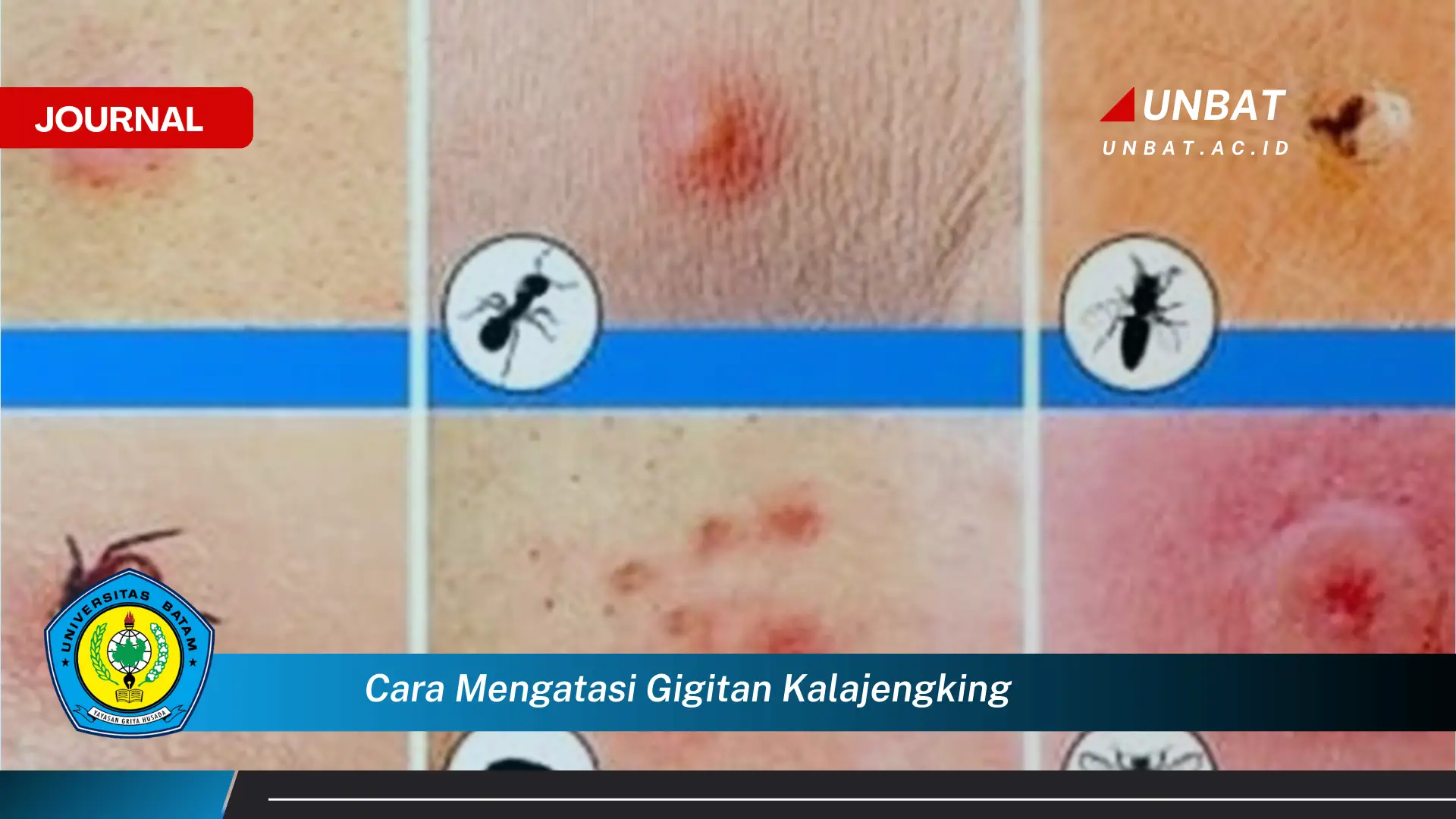 Ketahui Cara Mengatasi Gigitan Kalajengking, Pertolongan Pertama yang Efektif dan Cepat Ketahui Cara Mengatasi Gigitan Kalajengking, Pertolongan Pertama yang Efektif dan Cepat