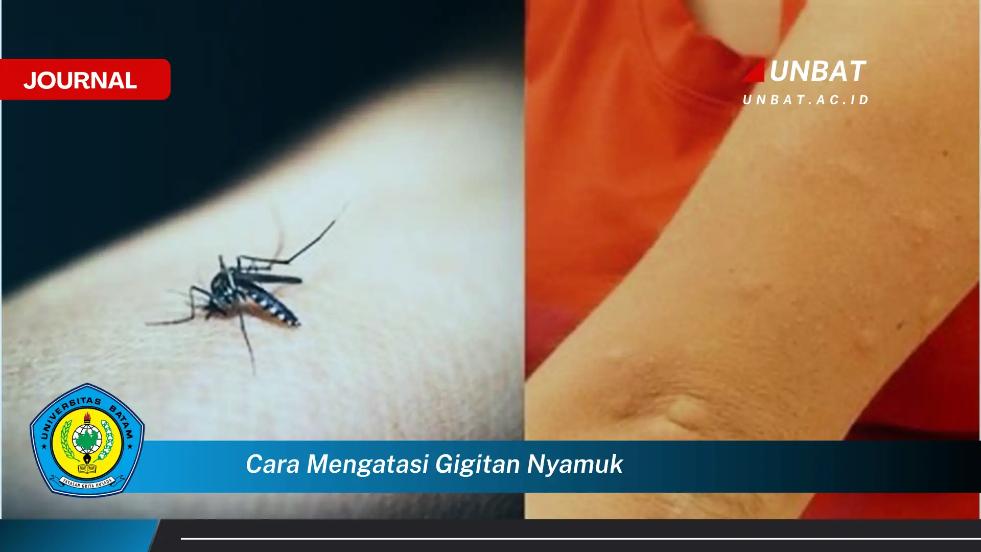 Ketahui Cara Mengatasi Gigitan Nyamuk yang Gatal dan Bengkak dengan Cepat Ketahui Cara Mengatasi Gigitan Nyamuk yang Gatal dan Bengkak dengan Cepat