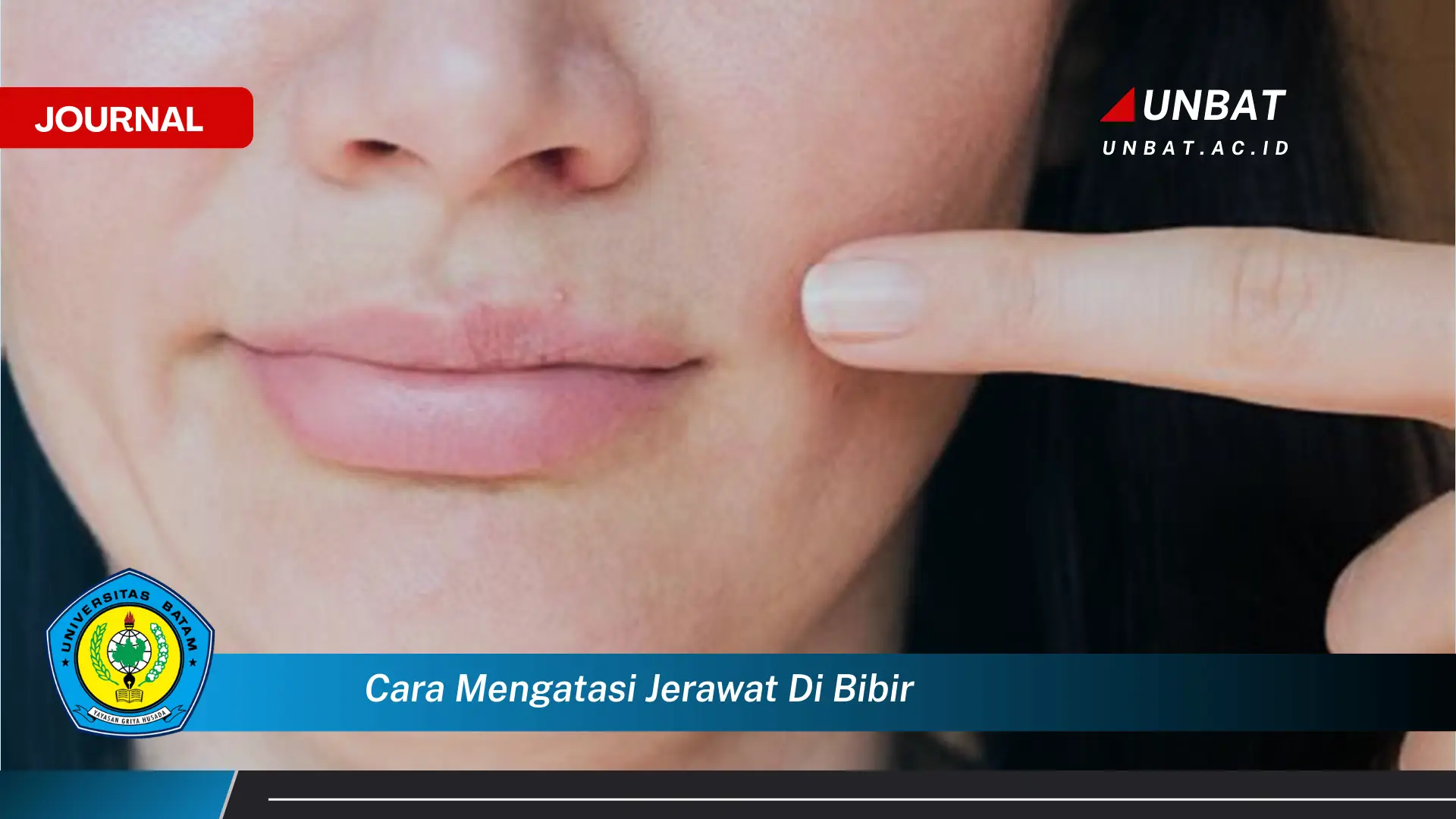 Ketahui Cara Mengatasi Jerawat di Bibir Secara Efektif dan Alami