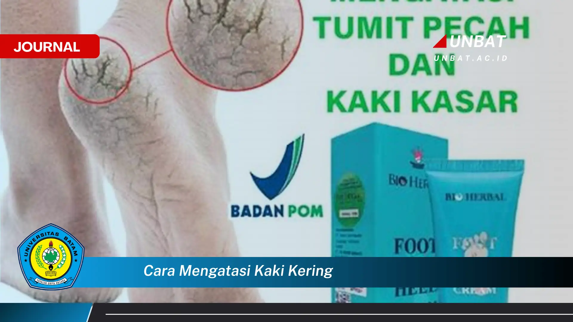 Ketahui Cara Mengatasi Kaki Kering dengan Cepat dan Alami