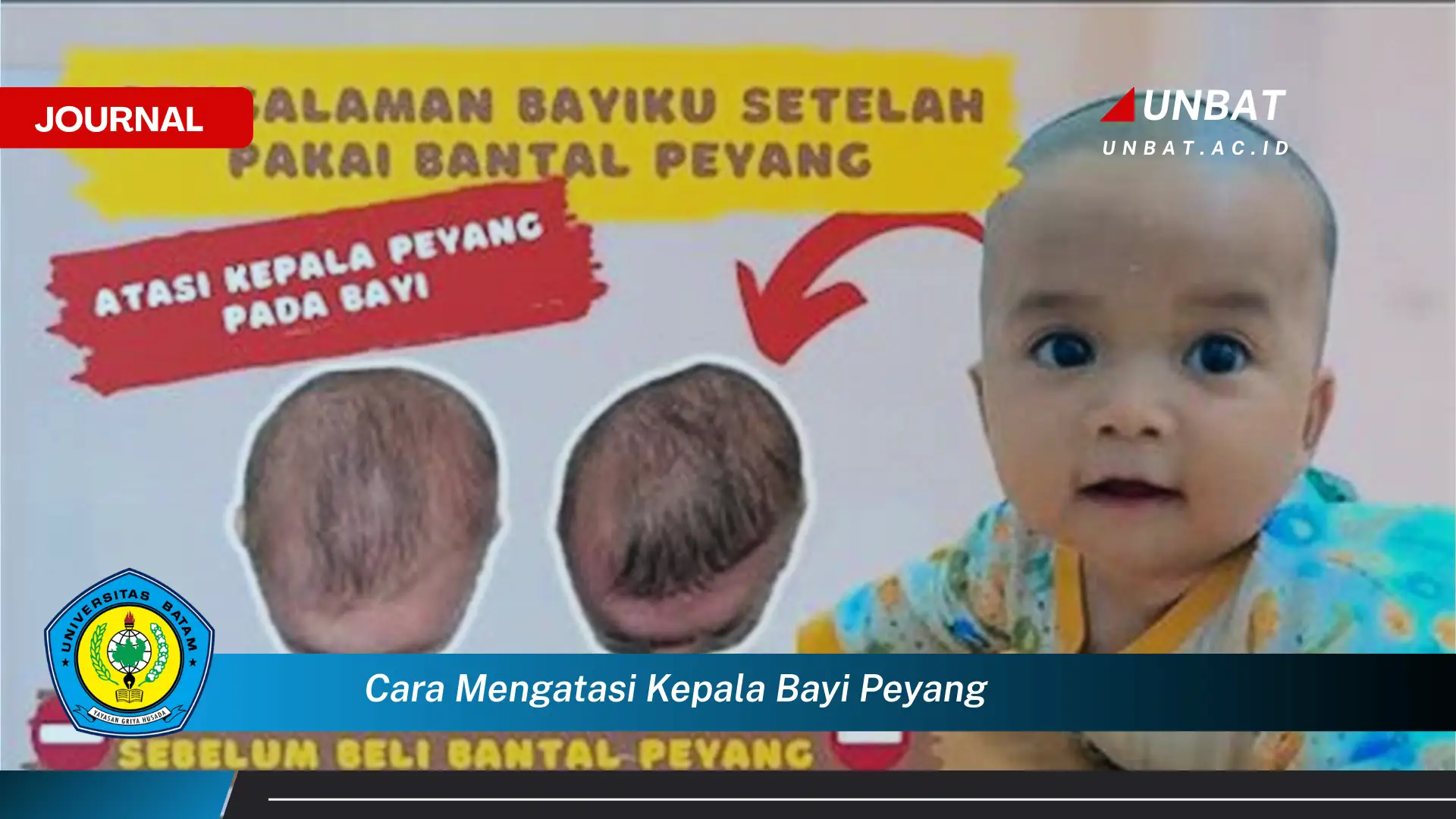 Ketahui Cara Mengatasi Kepala Bayi Peyang Secara Efektif dan Aman