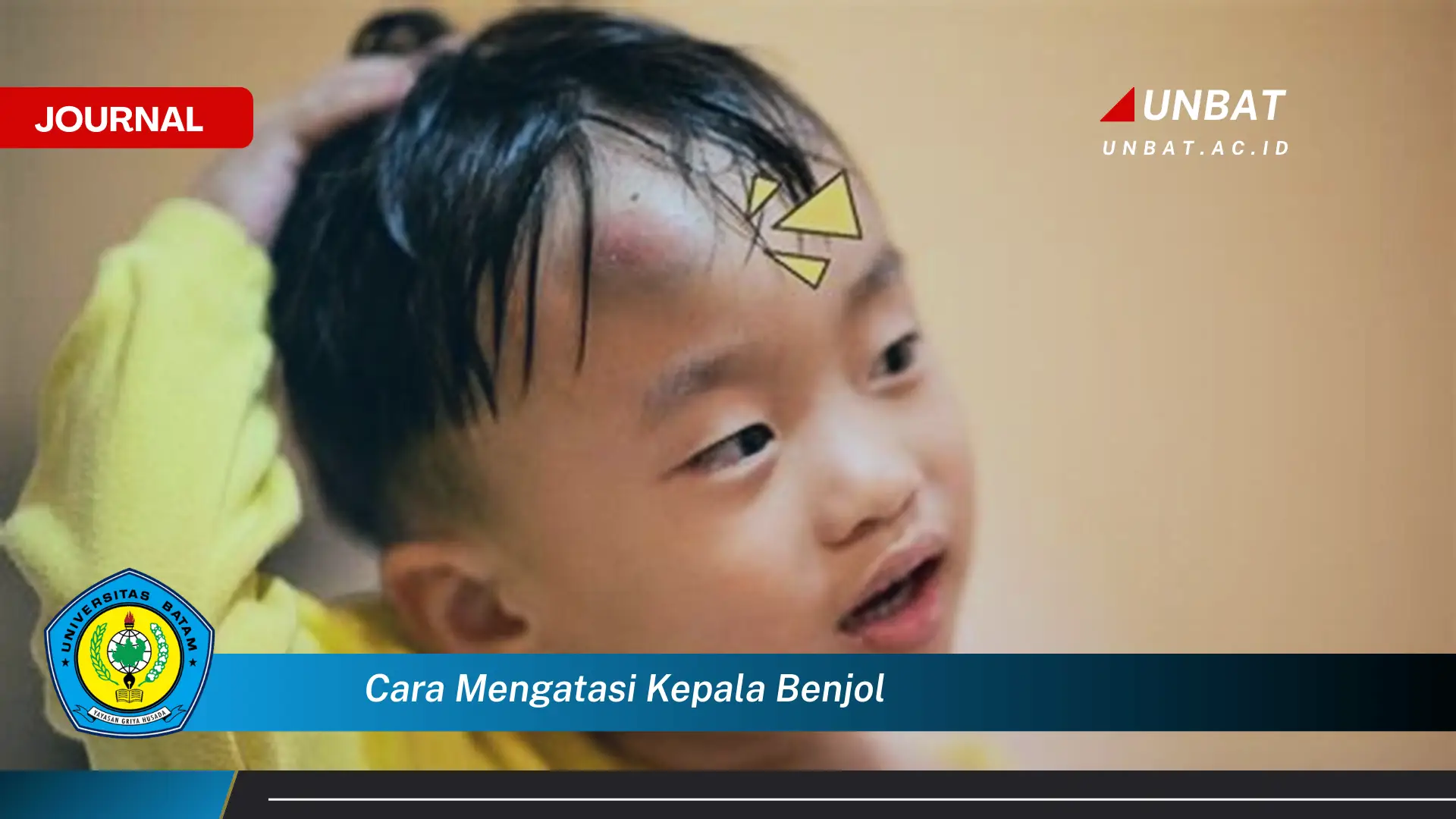 Ketahui Cara Mengatasi Kepala Benjol dengan Cepat dan Mudah Ketahui Cara Mengatasi Kepala Benjol dengan Cepat dan Mudah