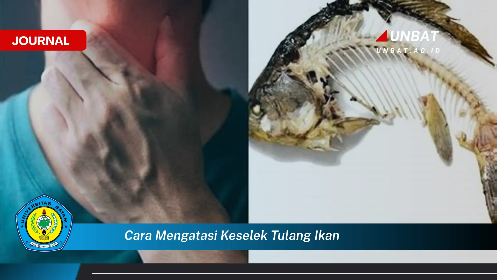 Ketahui Cara Mengatasi Keselek Tulang Ikan yang Efektif dan Aman