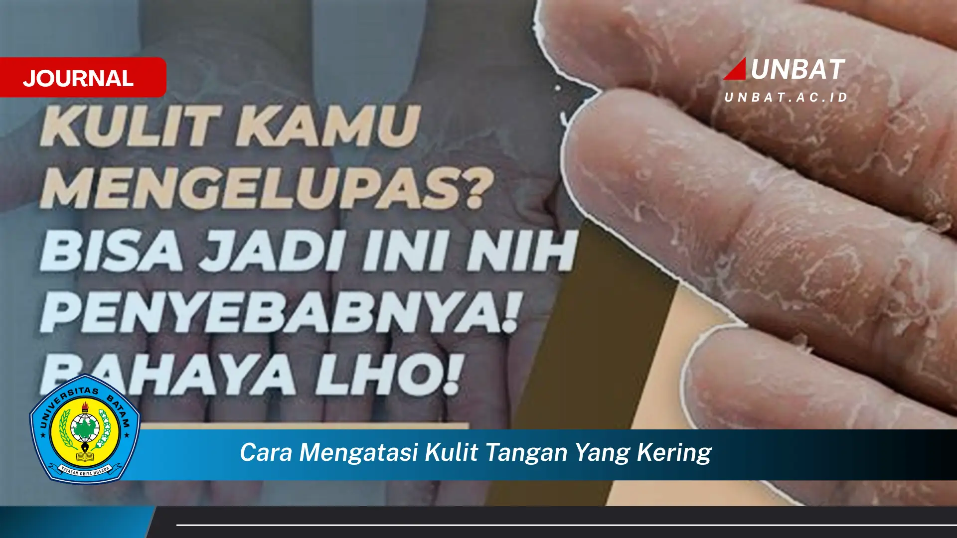 Ketahui Cara Mengatasi Kulit Tangan yang Kering dengan Cepat dan Alami Ketahui Cara Mengatasi Kulit Tangan yang Kering dengan Cepat dan Alami