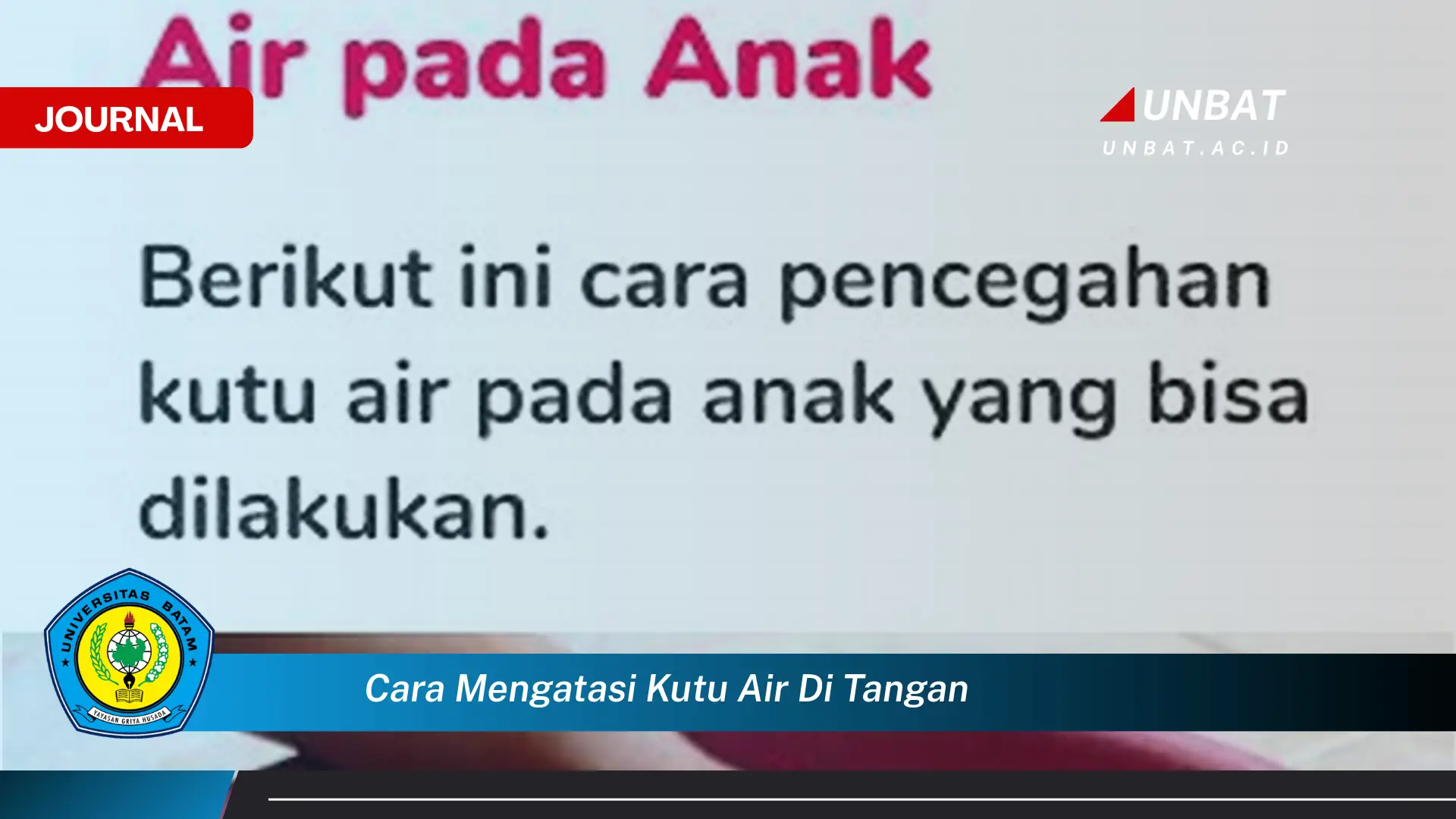 Ketahui Cara Mengatasi Kutu Air di Tangan Secara Efektif dan Alami