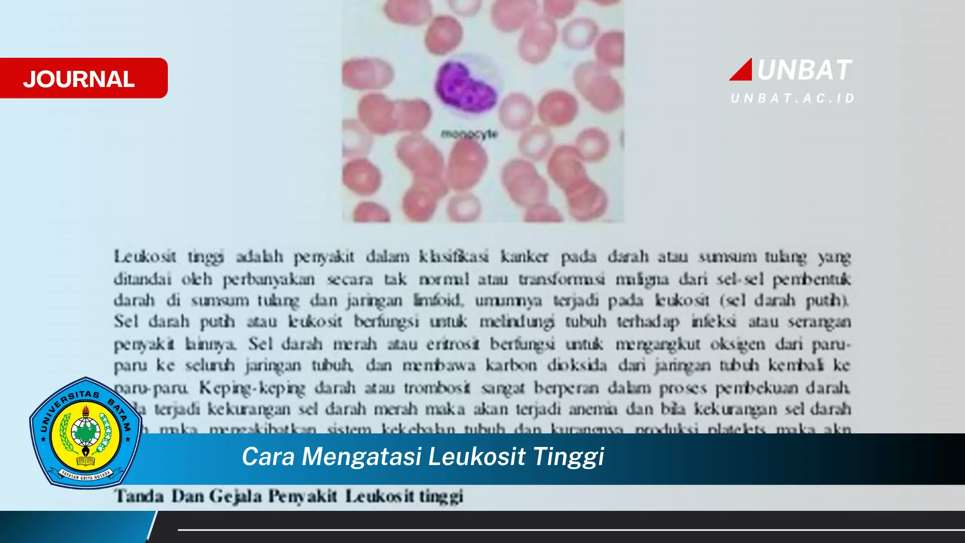 Ketahui Cara Mengatasi Leukosit Tinggi Secara Alami dan Efektif Ketahui Cara Mengatasi Leukosit Tinggi Secara Alami dan Efektif