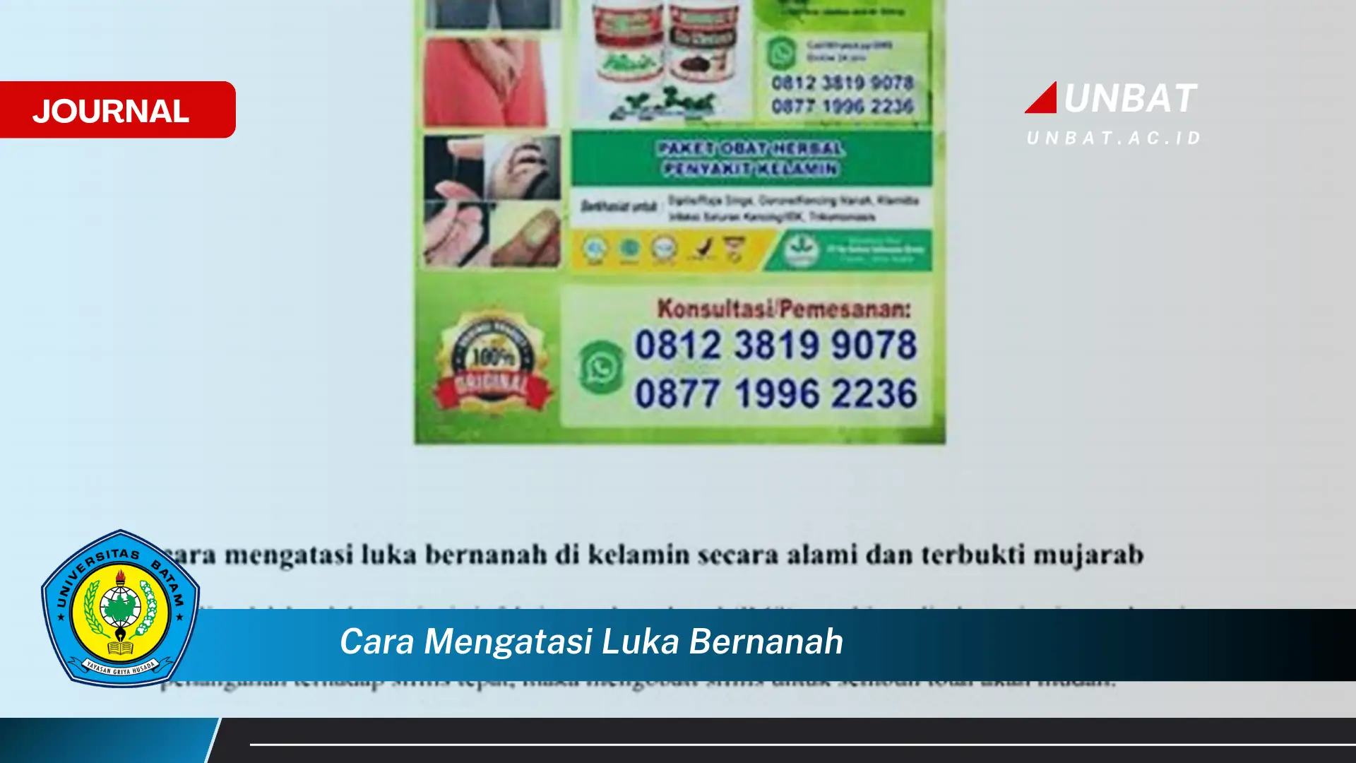 Ketahui Cara Mengatasi Luka Bernanah dengan Cepat dan Efektif Ketahui Cara Mengatasi Luka Bernanah dengan Cepat dan Efektif