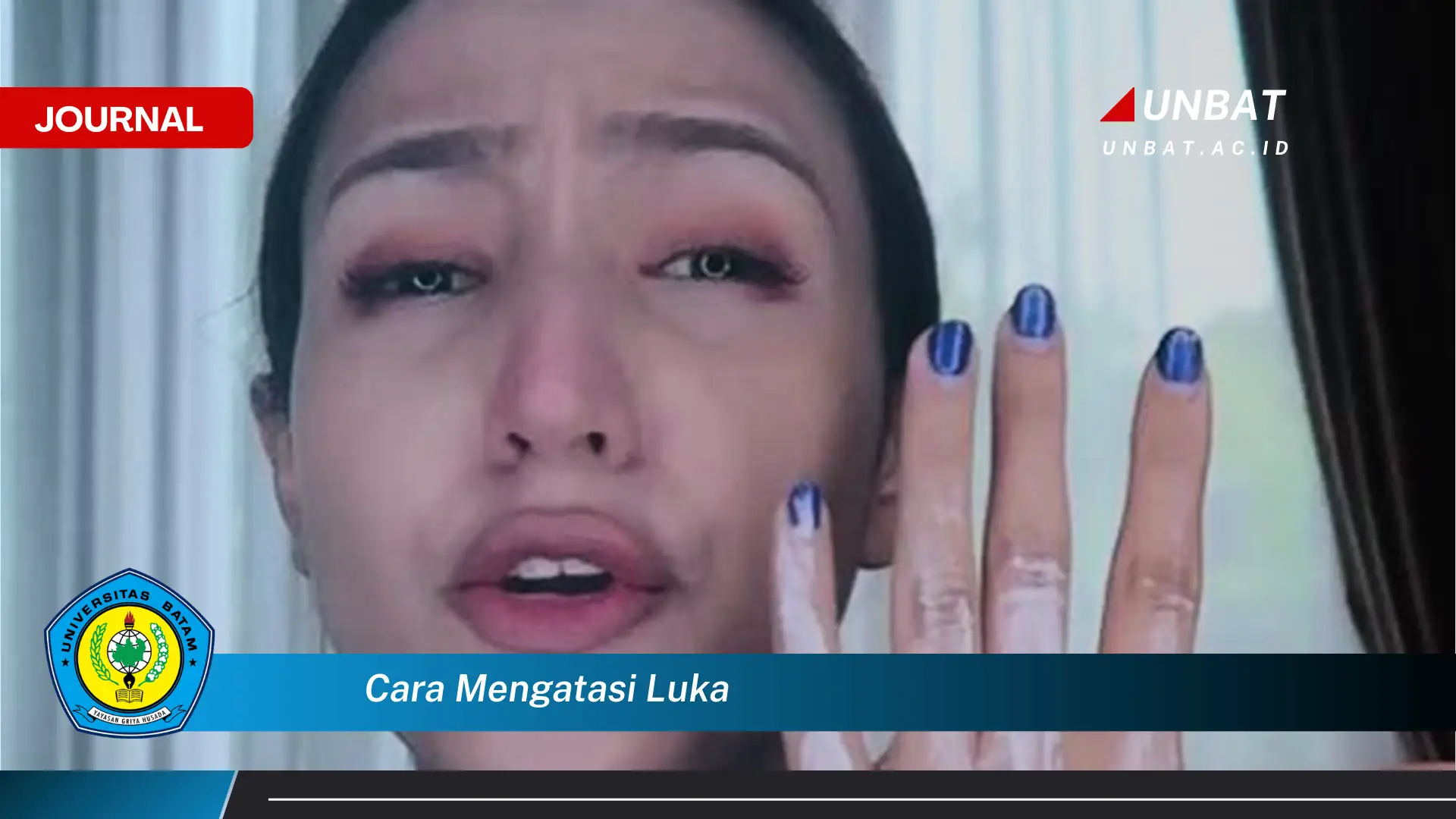 Ketahui Cara Mengatasi Luka dengan Cepat dan Efektif Ketahui Cara Mengatasi Luka dengan Cepat dan Efektif