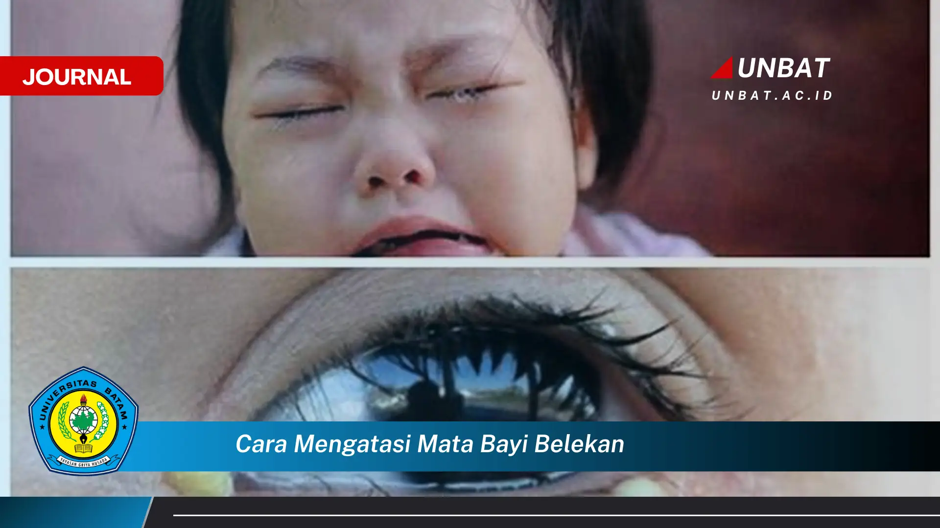 Ketahui Cara Mengatasi Mata Bayi Belekan Secara Efektif dan Aman