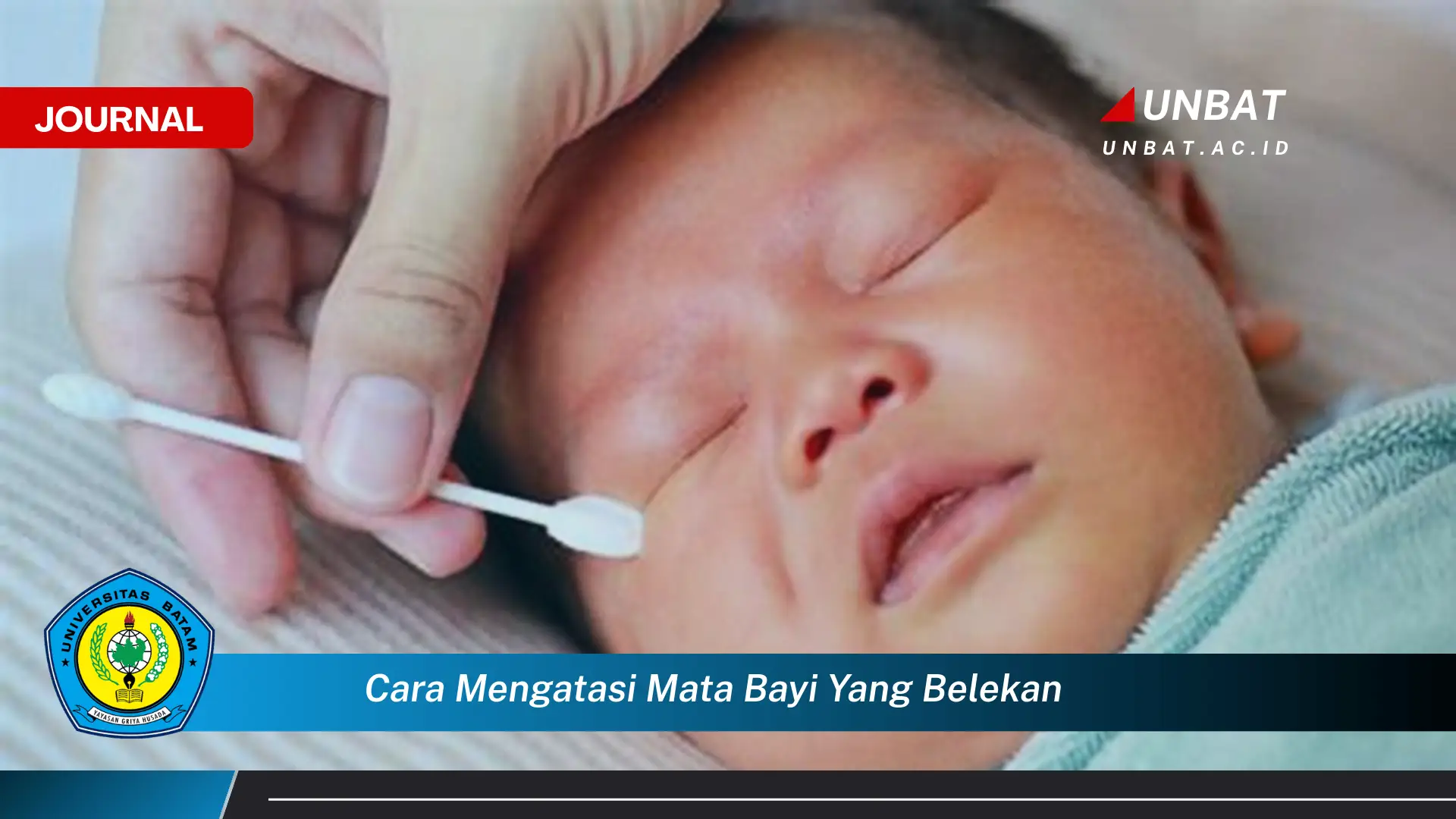 Ketahui Cara Mengatasi Mata Bayi yang Belekan Secara Efektif dan Alami Ketahui Cara Mengatasi Mata Bayi yang Belekan Secara Efektif dan Alami
