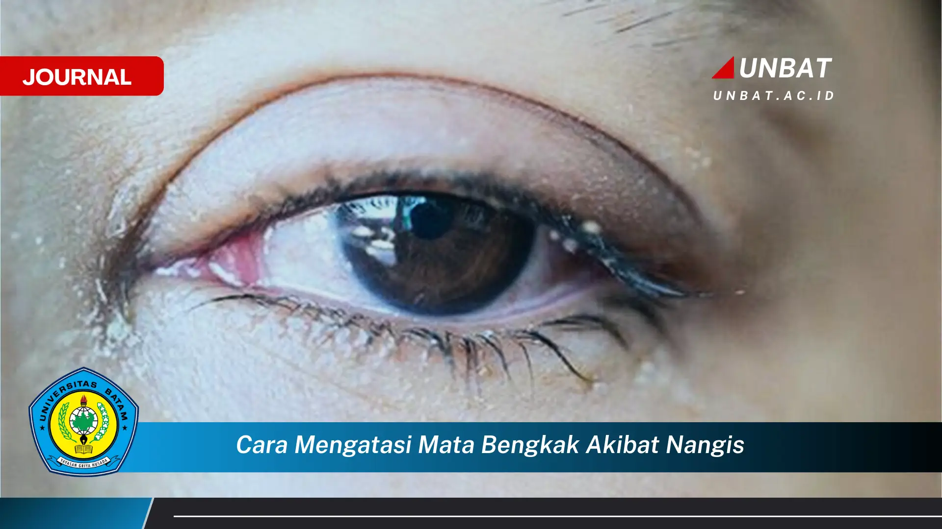 Ketahui Cara Mengatasi Mata Bengkak Akibat Nangis dengan Cepat dan Alami Ketahui Cara Mengatasi Mata Bengkak Akibat Nangis dengan Cepat dan Alami
