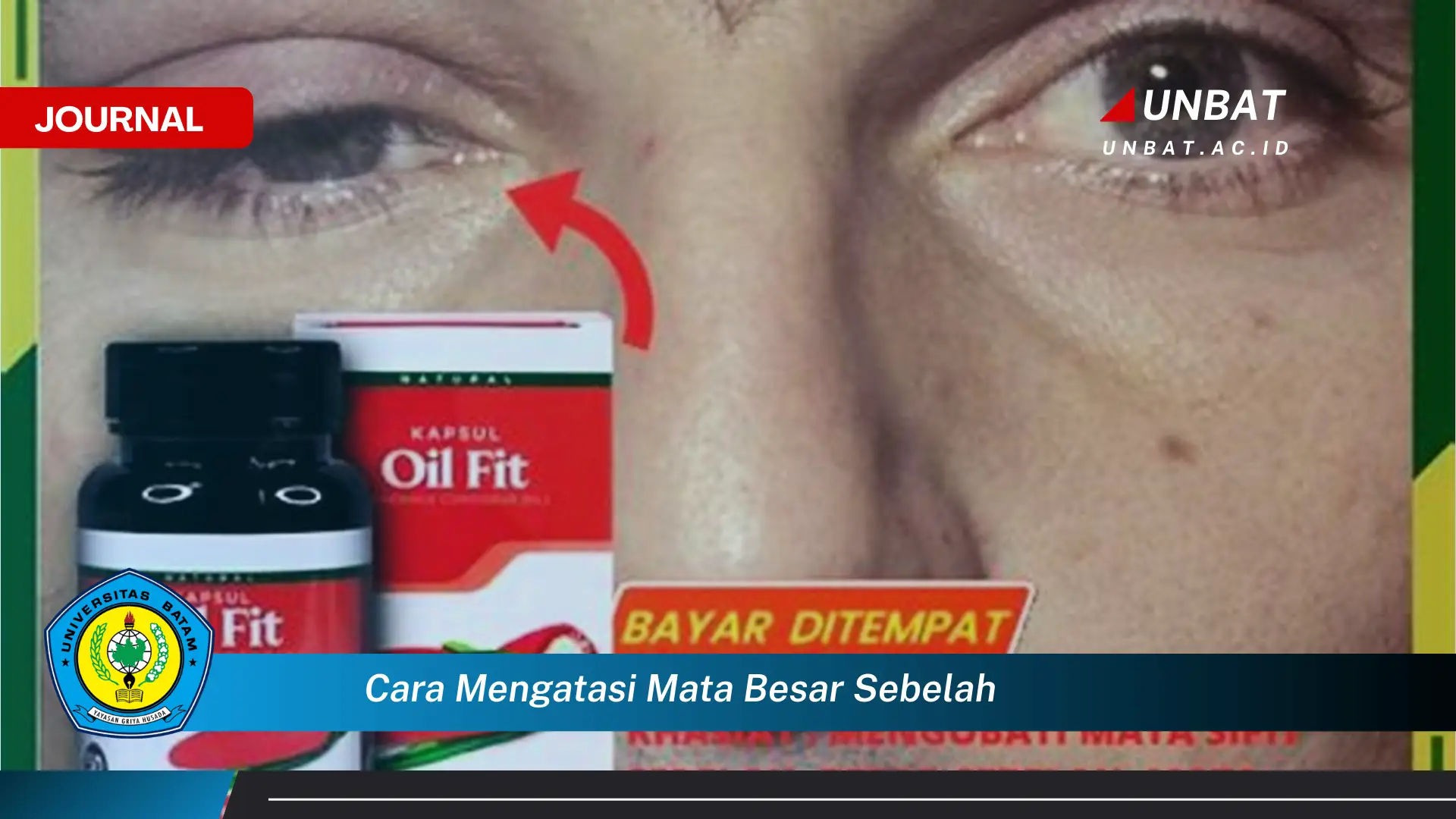 Ketahui Cara Mengatasi Mata Besar Sebelah Secara Efektif dan Alami Ketahui Cara Mengatasi Mata Besar Sebelah Secara Efektif dan Alami