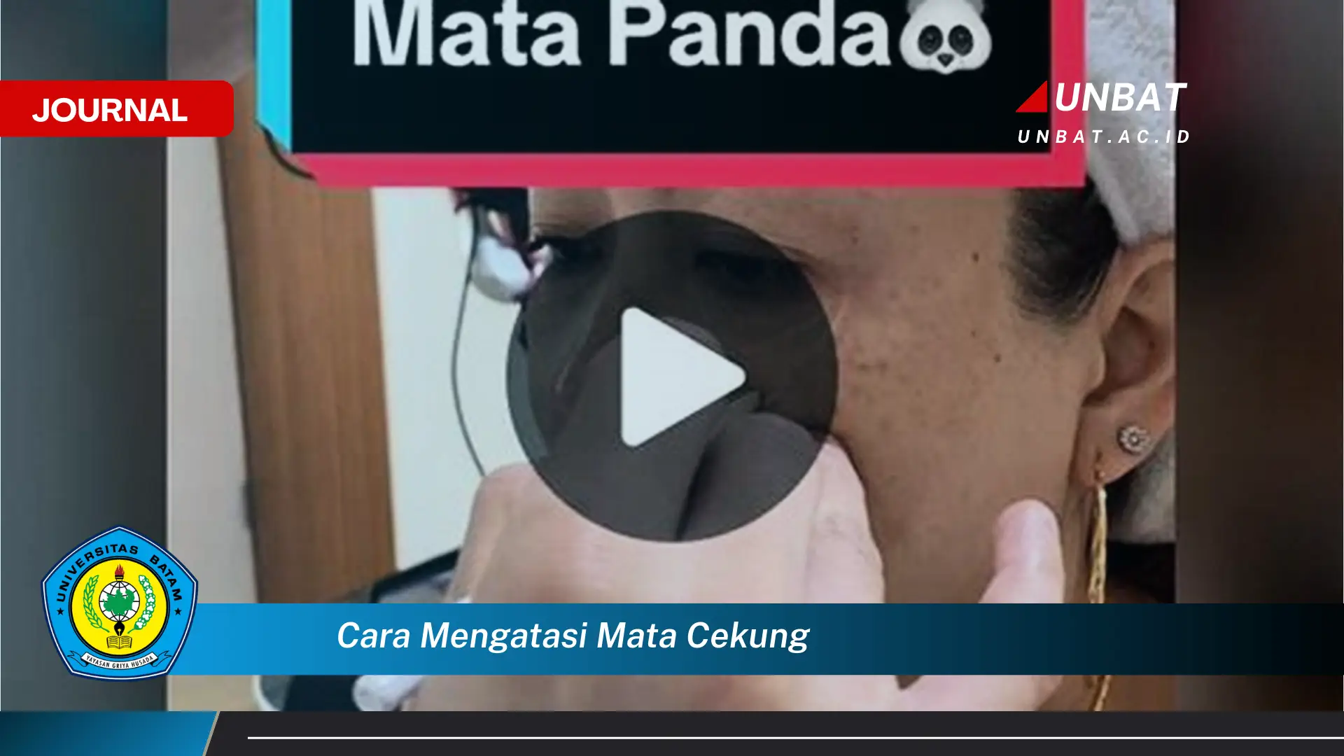 Ketahui Cara Mengatasi Mata Cekung dengan Cepat dan Mudah Ketahui Cara Mengatasi Mata Cekung dengan Cepat dan Mudah