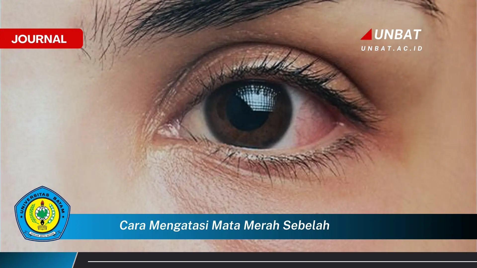 Ketahui Cara Mengatasi Mata Merah Sebelah dengan Aman dan Efektif di Rumah