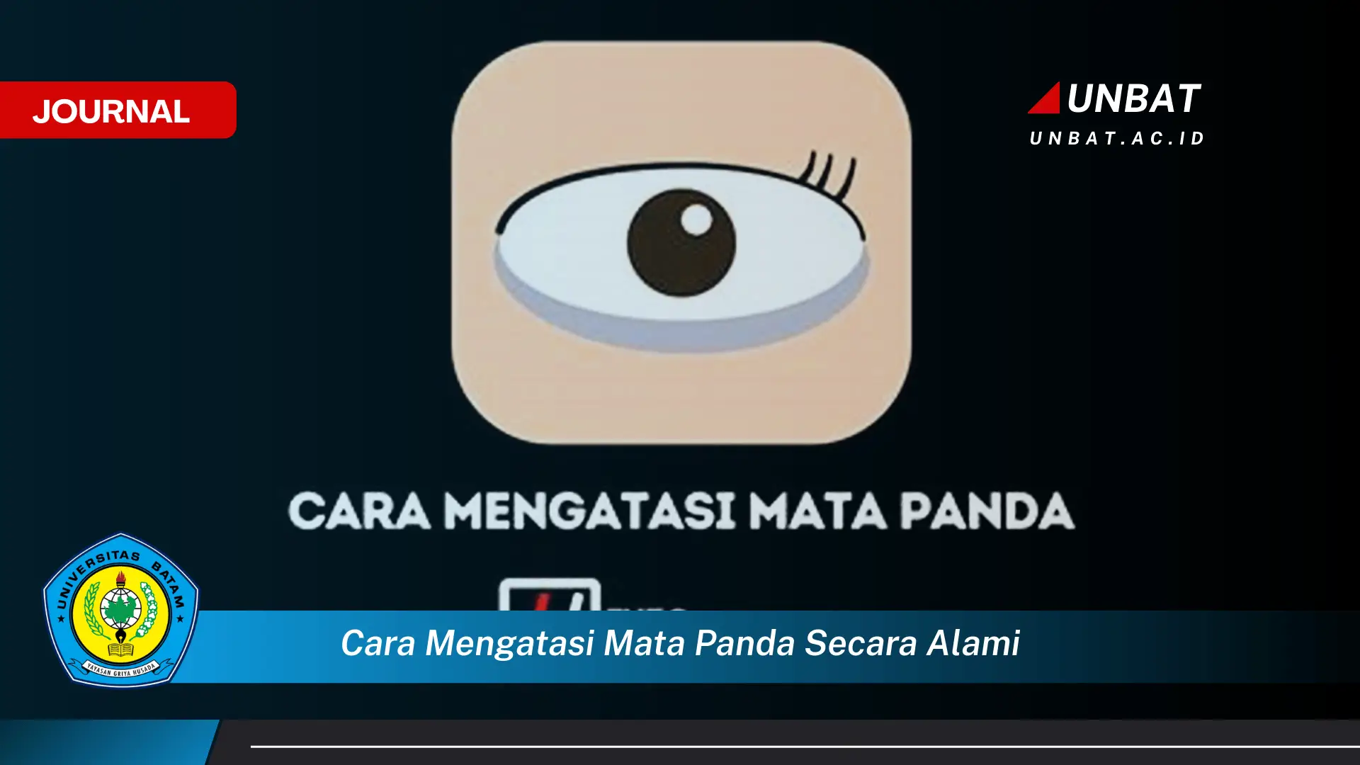 Ketahui Cara Mengatasi Mata Panda Secara Alami, Tips Ampuh dan Mudah Dilakukan di Rumah