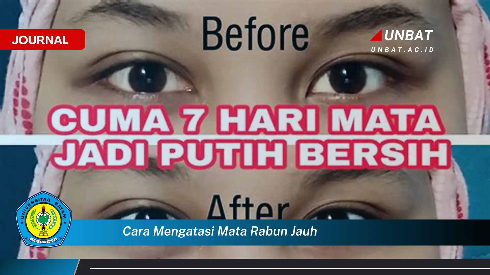 Ketahui Cara Mengatasi Mata Rabun Jauh Secara Efektif dan Alami Ketahui Cara Mengatasi Mata Rabun Jauh Secara Efektif dan Alami