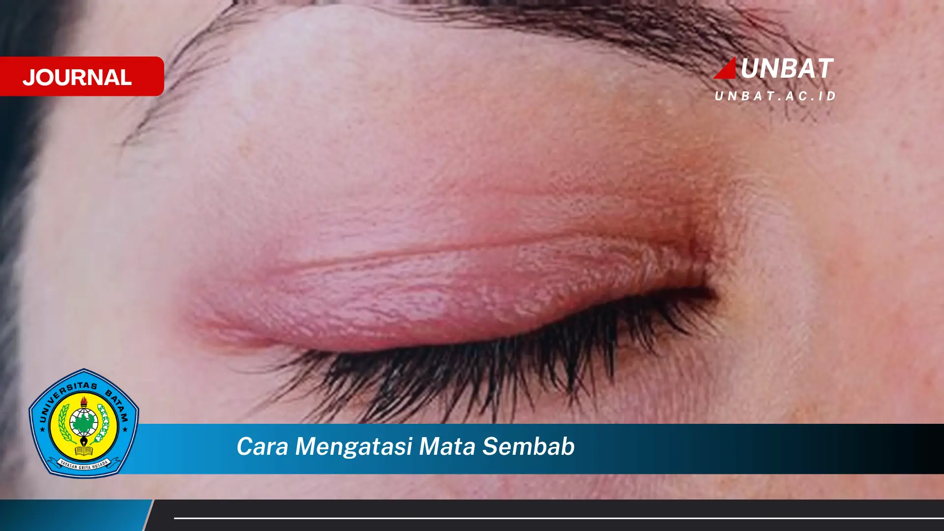 Ketahui Cara Mengatasi Mata Sembab dengan Cepat dan Alami