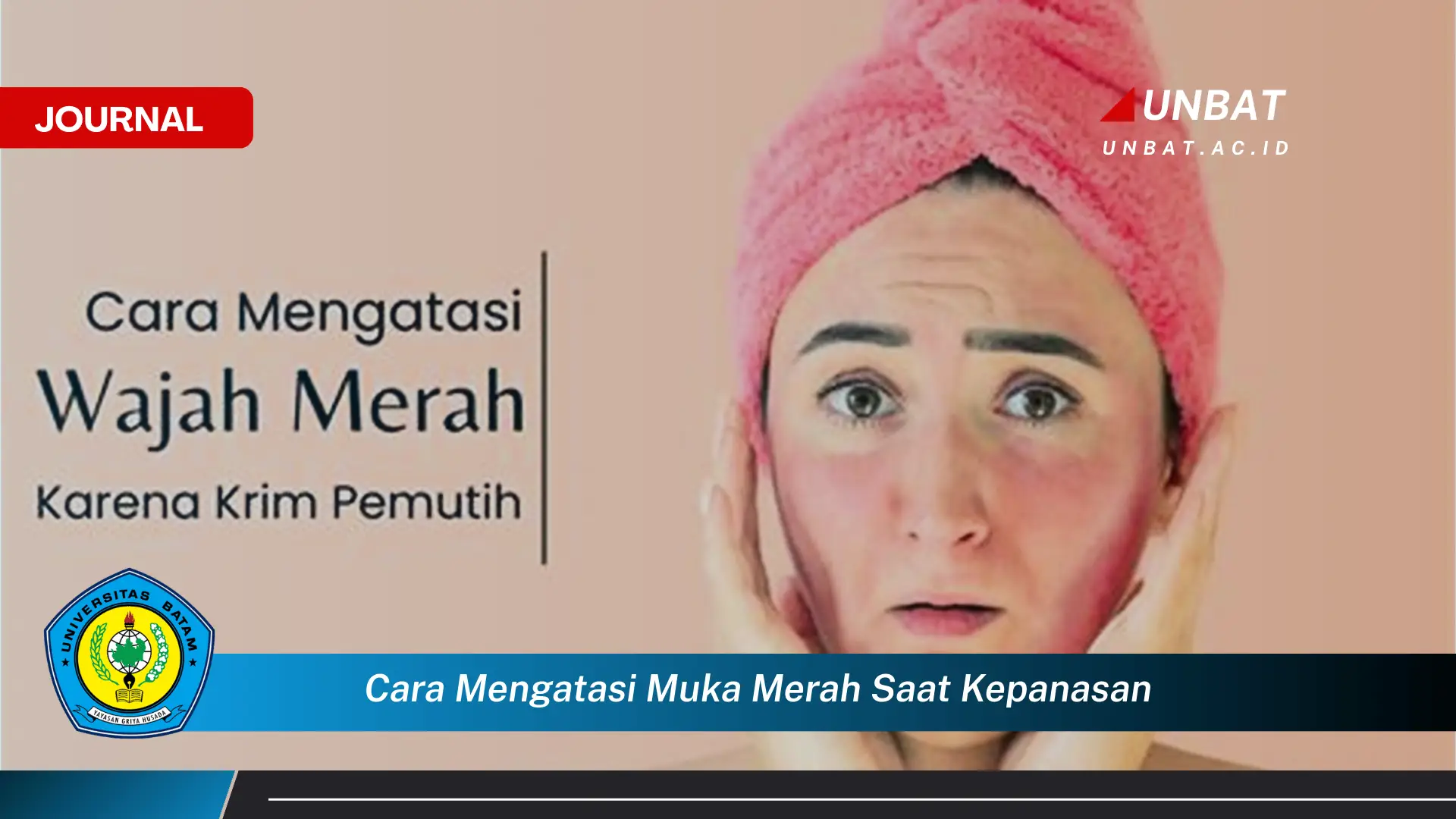 Ketahui Cara Mengatasi Muka Merah Saat Kepanasan dengan Cepat dan Alami