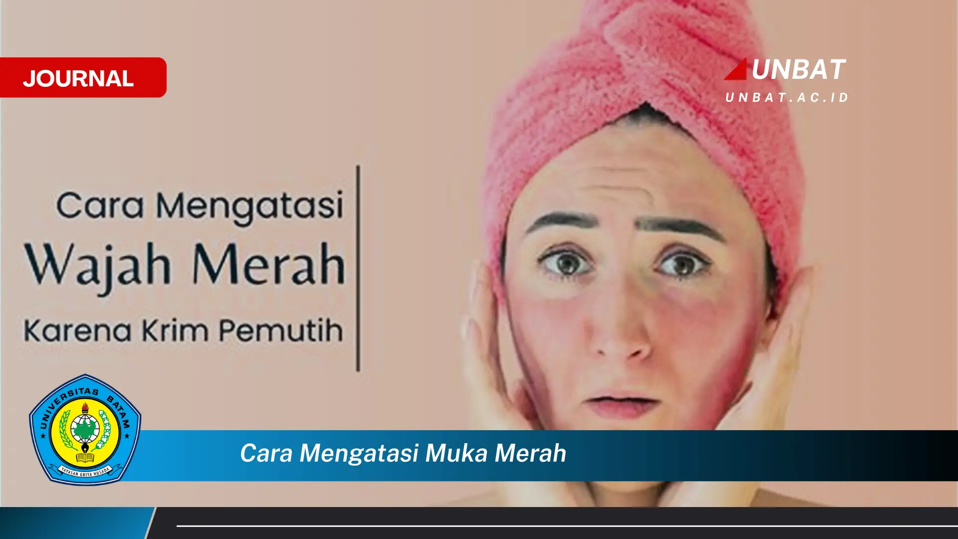 Ketahui Cara Mengatasi Muka Merah, Penyebab, Perawatan, dan Pencegahan Ketahui Cara Mengatasi Muka Merah, Penyebab, Perawatan, dan Pencegahan