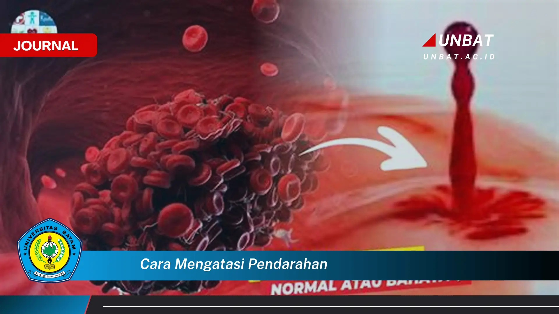 Ketahui Cara Mengatasi Pendarahan dengan Cepat dan Tepat