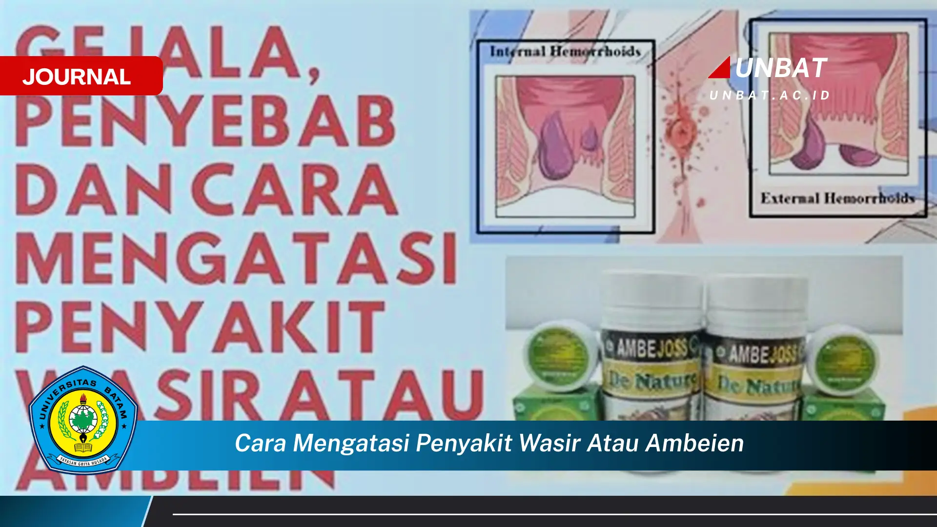 Ketahui Cara Mengatasi Penyakit Wasir atau Ambeien Secara Alami dan Efektif