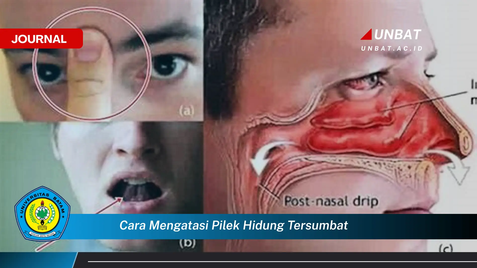 Ketahui Cara Mengatasi Pilek Hidung Tersumbat dengan Cepat dan Alami