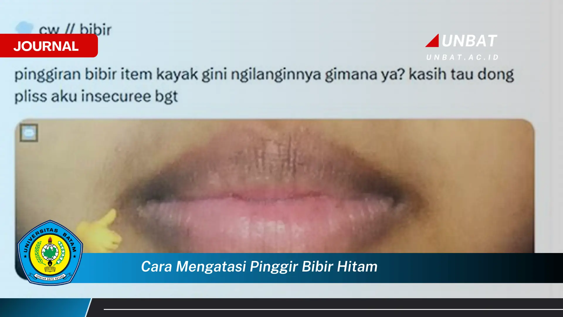 Ketahui Cara Mengatasi Pinggir Bibir Hitam Secara Alami dan Efektif