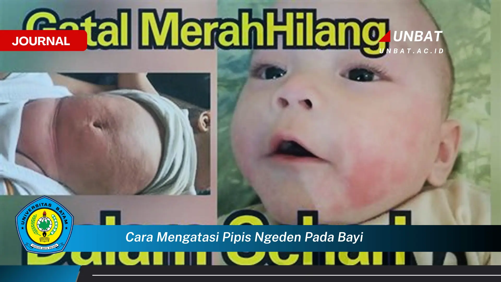 Ketahui Cara Mengatasi Pipis Ngeden pada Bayi Secara Efektif dan Aman