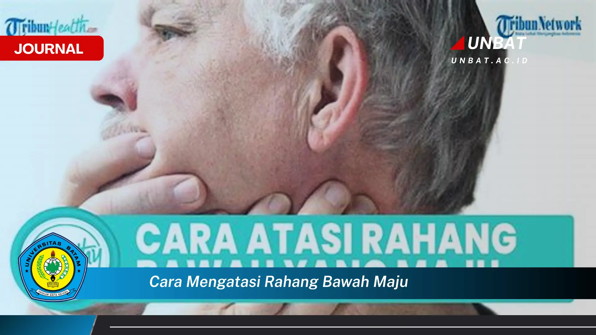 Ketahui Cara Mengatasi Rahang Bawah Maju, Panduan Lengkap dan Efektif