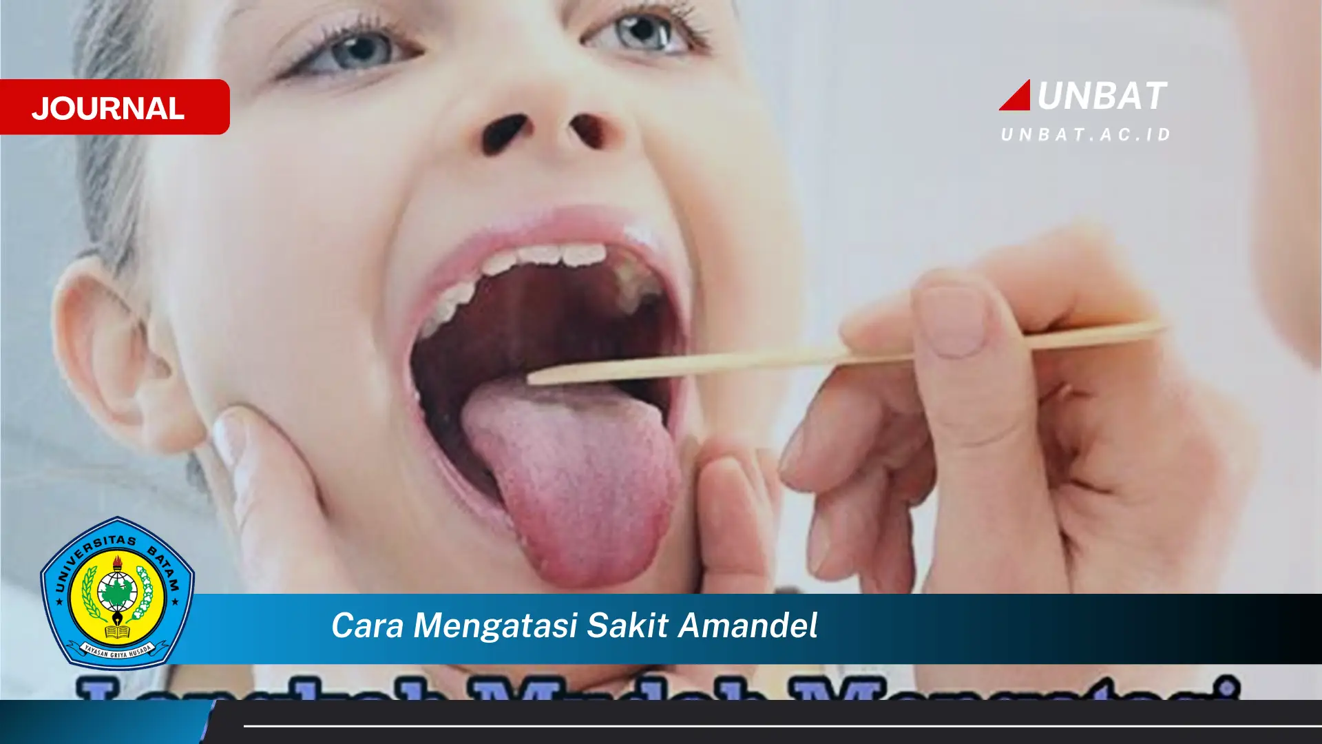 Ketahui Cara Mengatasi Sakit Amandel dengan Cepat dan Alami