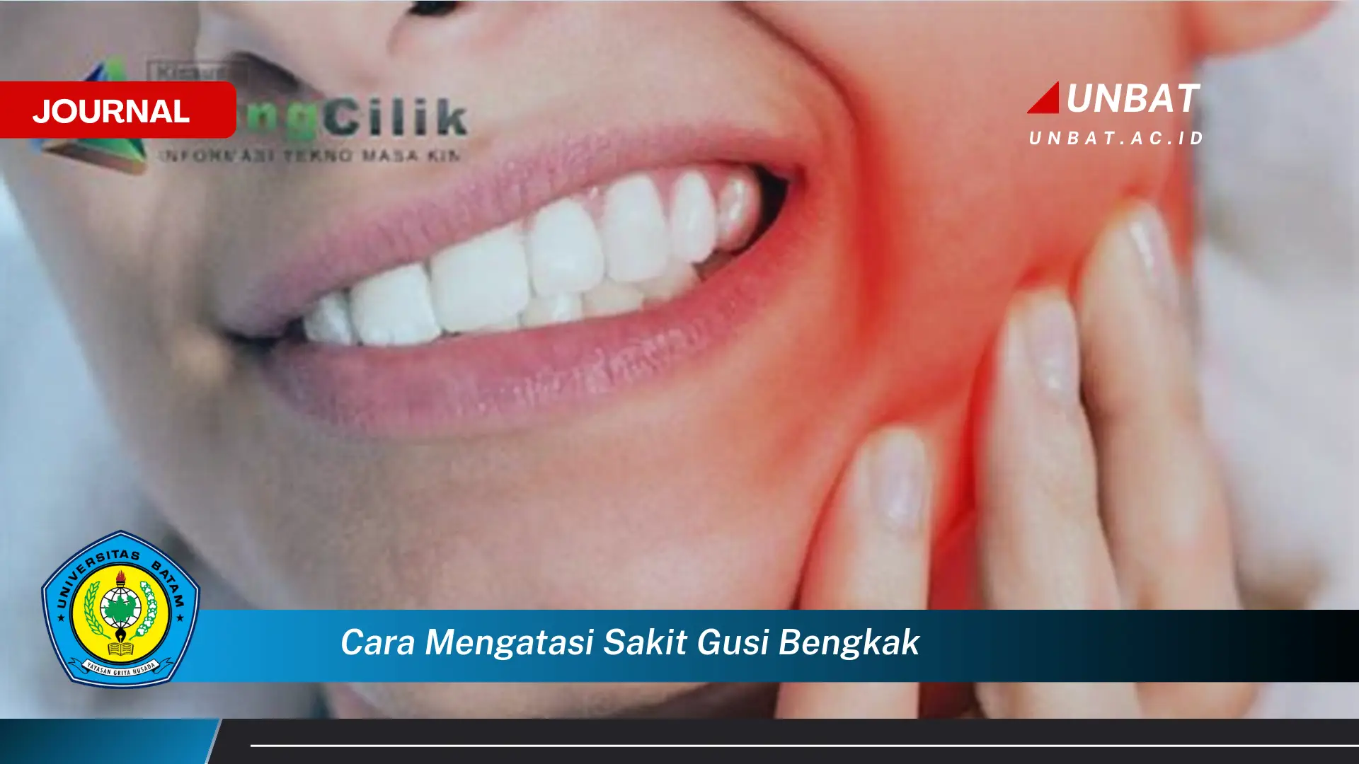 Ketahui Cara Mengatasi Sakit Gusi Bengkak dengan Bahan Alami di Rumah