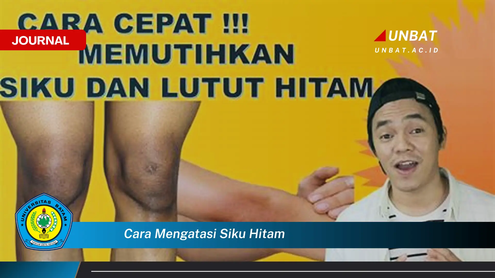 Inilah Cara Mengatasi Siku Hitam, Tips Ampuh dan Mudah Dilakukan di Rumah