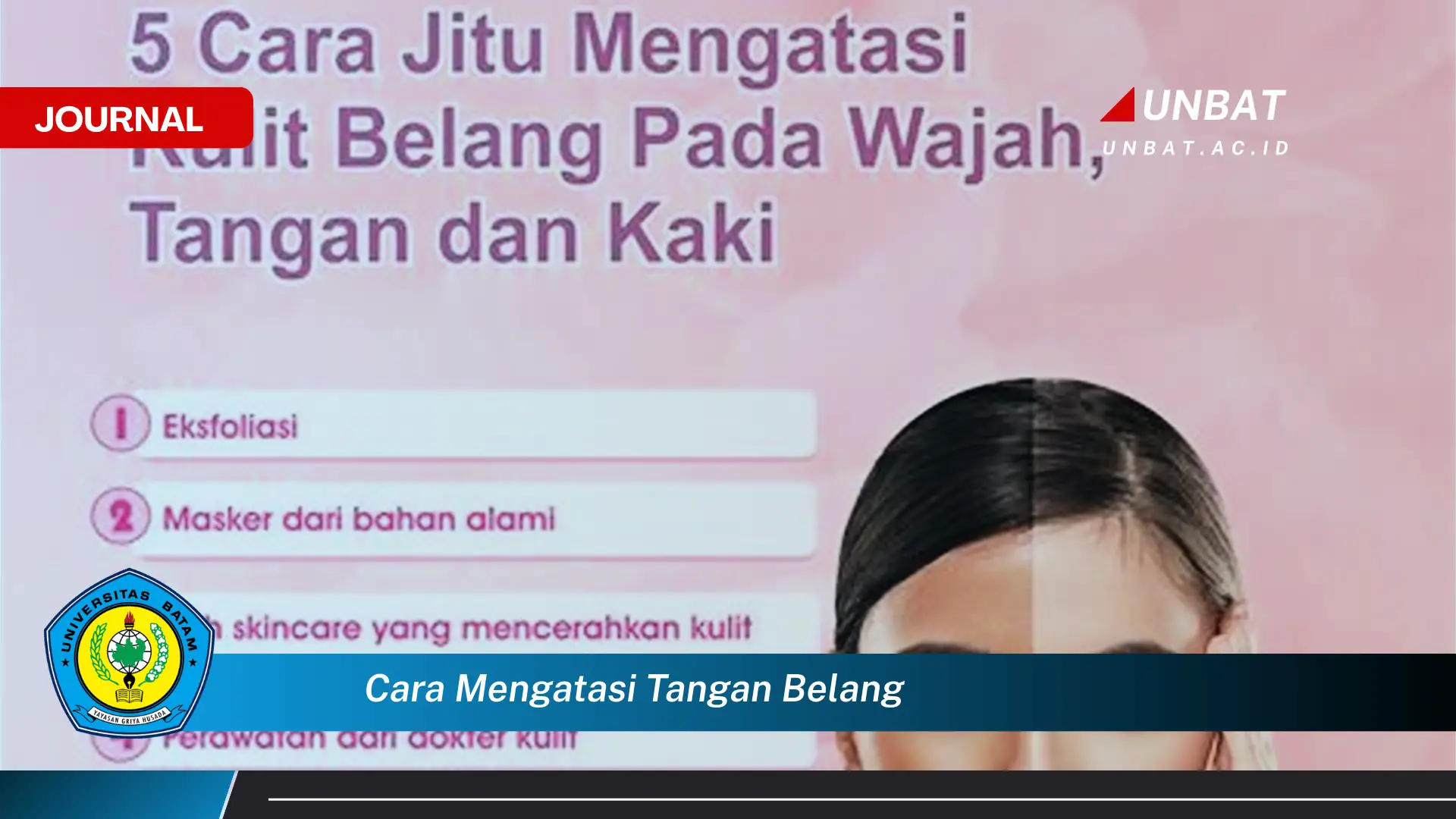 Ketahui Cara Mengatasi Tangan Belang Secara Efektif dan Alami Ketahui Cara Mengatasi Tangan Belang Secara Efektif dan Alami
