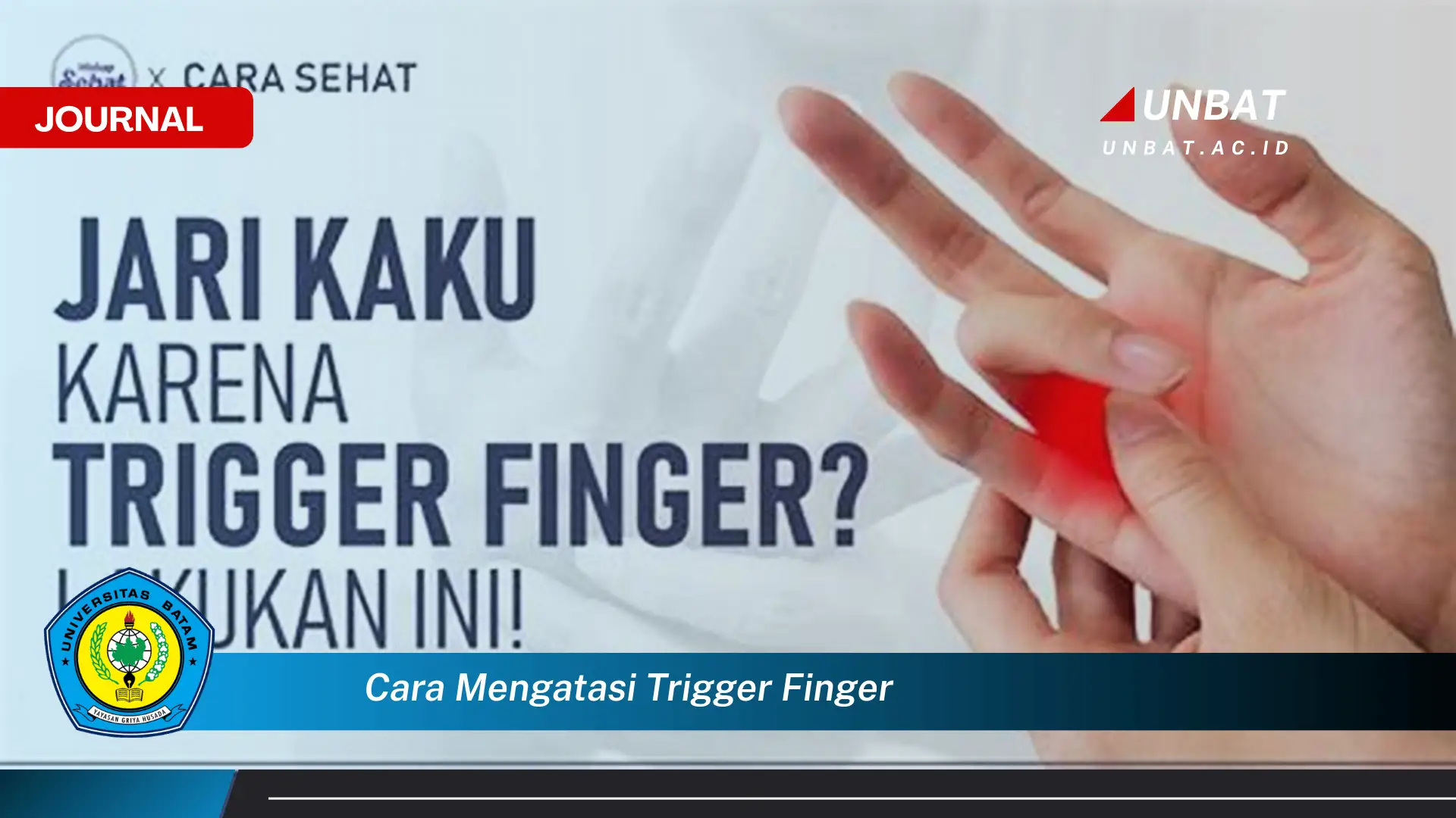 Ketahui Cara Mengatasi Trigger Finger, Panduan Lengkap dan Efektif